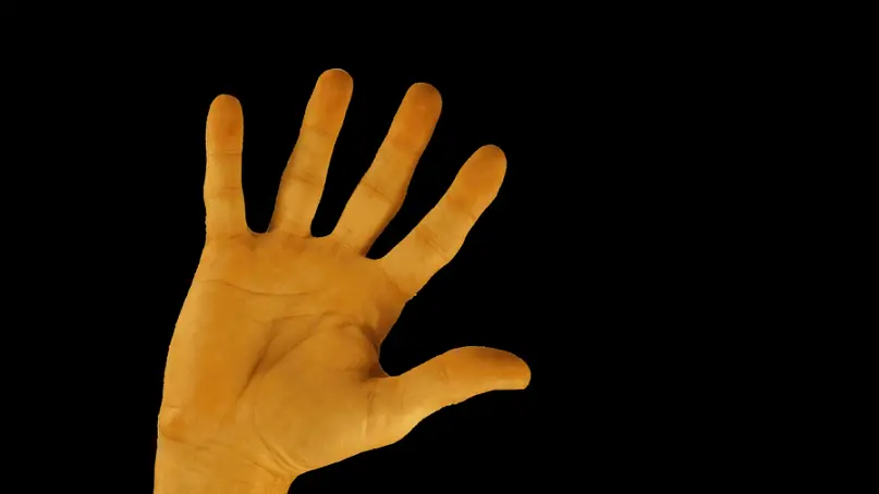 Color of the hand turns yellow in color