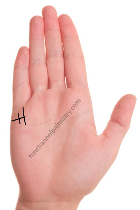 Vertical line cutting marriage line