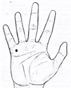 Mole on the mount of mercury