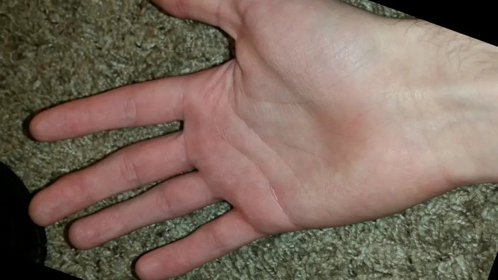 Palm Analysis of a stressed person