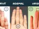 Length of the fingers and your personality