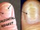 Horizontal Ridges on nails