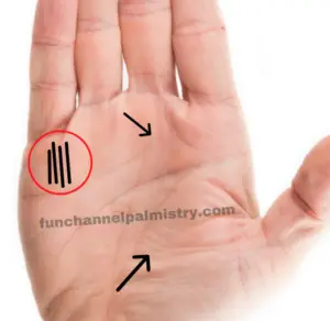 Medical Stigmata Lines And Many Lines On Mount Of Mercury-Palmistry