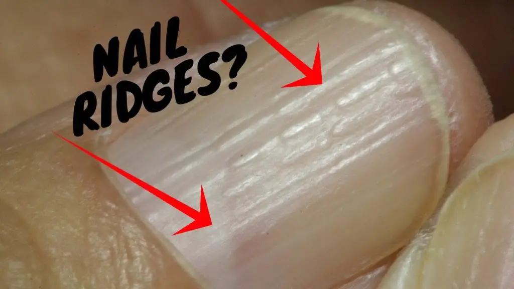 what-causes-ridges-in-your-fingernails-medicalrecords