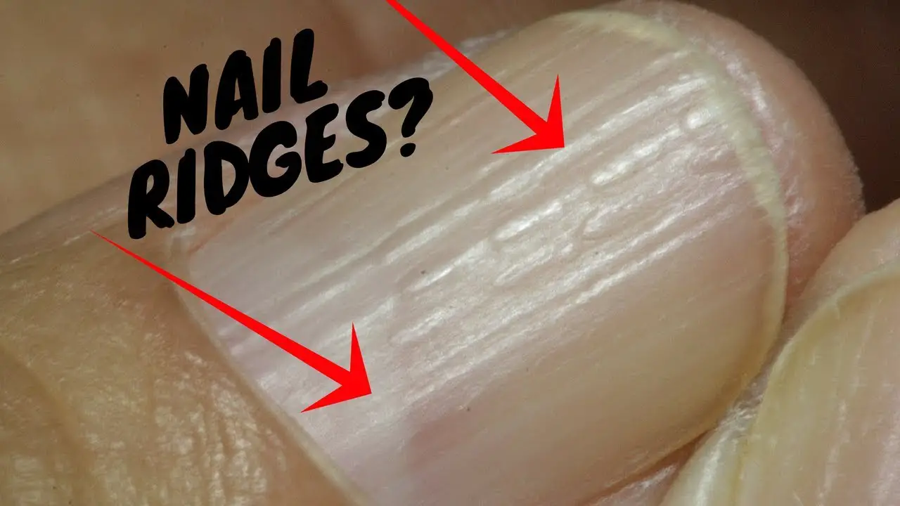 vertical nail ridges