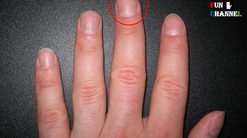 Half moon on middle finger