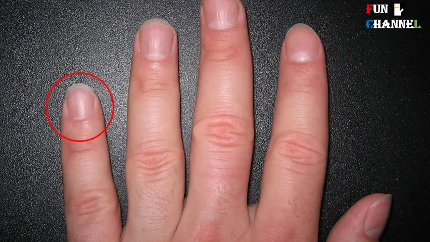 Half moon on little finger