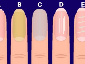nails tells a lot about your health