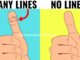 horizontal lines on thumb