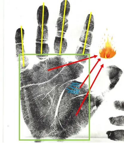Ted Bundy aggression and fire hand