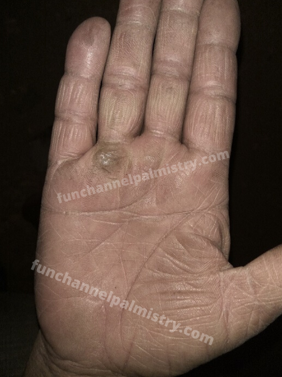 Enemy lines in palmistry