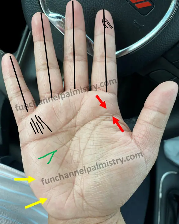 radial loop fingerprint on Jupiter finger