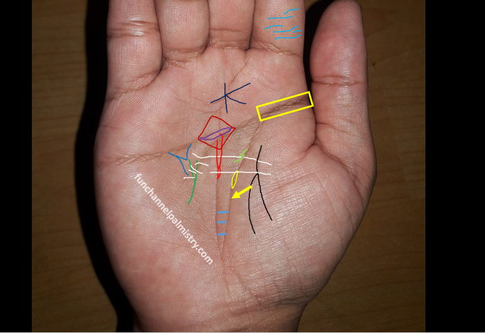 Island on life line and fate line